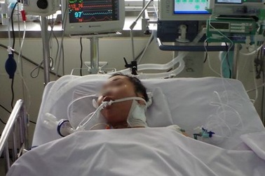 Hiếm gặp: bệnh nhân nhồi máu cơ tim cấp vì bị ong đốt