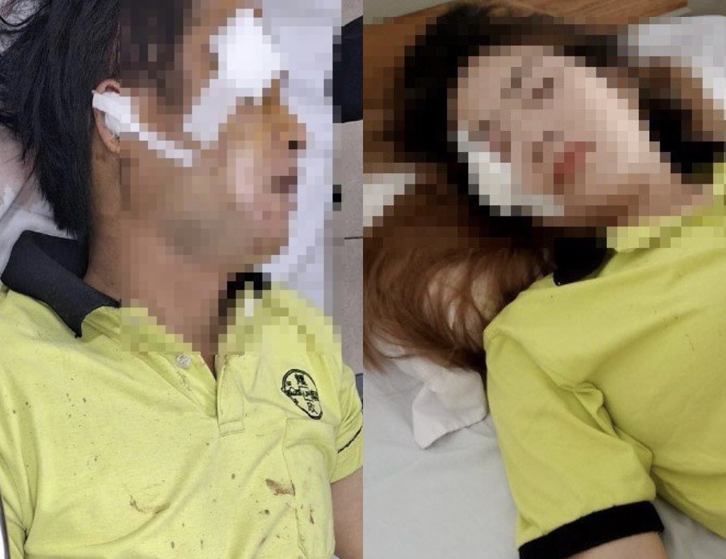 Hai vợ chồng thương nặng sau khi bị đàn chó rượt đuổi - 1 Hai vợ chồng thương nặng sau khi bị đàn chó rượt đuổi - 1