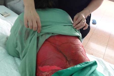 Thực phẩm chức năng cũng có thể gây hại