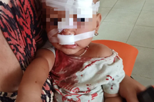 Vợ chồng cãi vã khiến con hai tuổi phải nhập viện cấp cứu