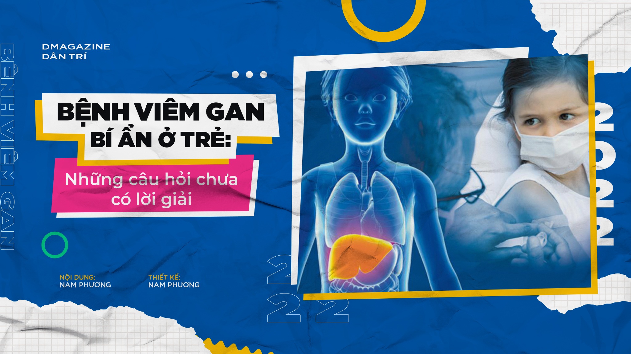 Bệnh viêm gan bí ẩn ở trẻ: Những câu hỏi chưa có lời giải