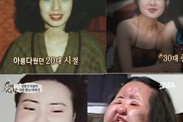 Những nhan sắc “dao kéo” thất bại của sao Hàn