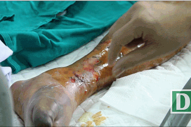 Hãi hùng với những hình ảnh liên cầu lợn “tấn công” người