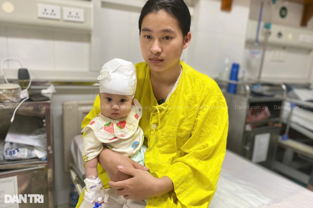 Bé 7 tháng tuổi khuyết hộp sọ, mẹ nghèo khẩn cầu cơ hội sống cho con - 4 Bé 7 tháng tuổi khuyết hộp sọ, mẹ nghèo khẩn cầu cơ hội sống cho con - 4