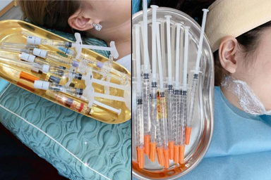 Thâm nhập spa chui: Tiêm filler tại phòng khách, cam kết miệng