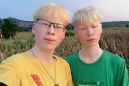 Cuộc sống "đặc biệt" của cặp song sinh bạch tạng hiếm gặp