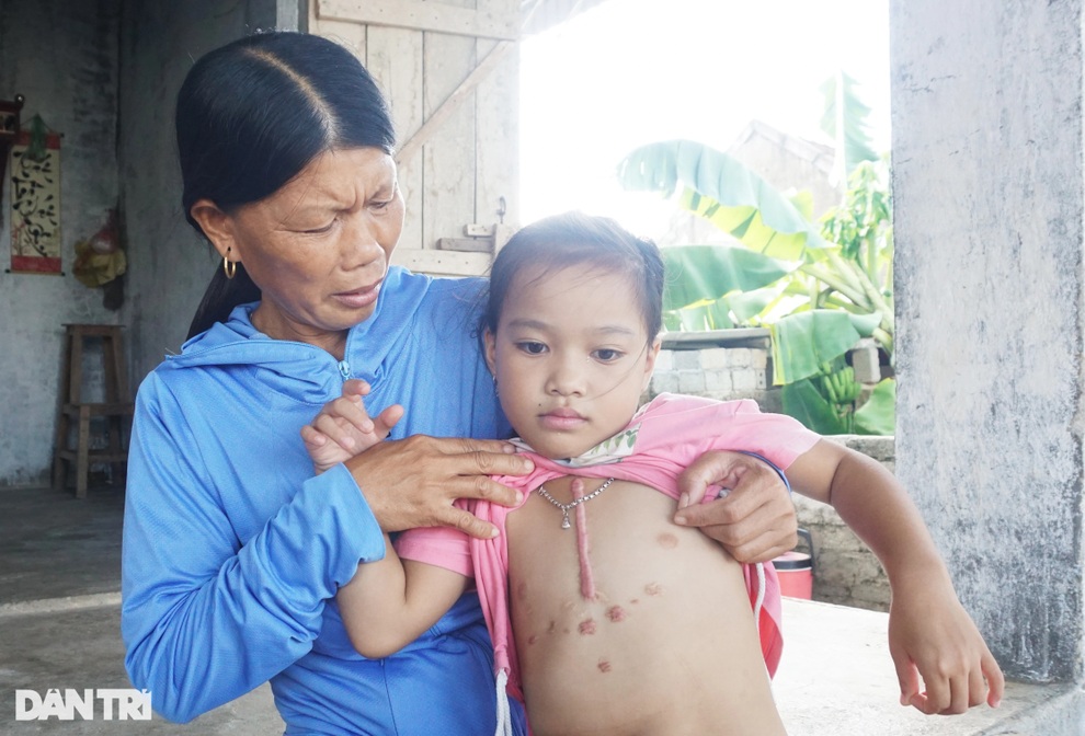 Chồng đuối nước, góa phụ khóc cạn nước mắt cầu xin sự sống cho con - 4 Chồng đuối nước, góa phụ khóc cạn nước mắt cầu xin sự sống cho con - 4