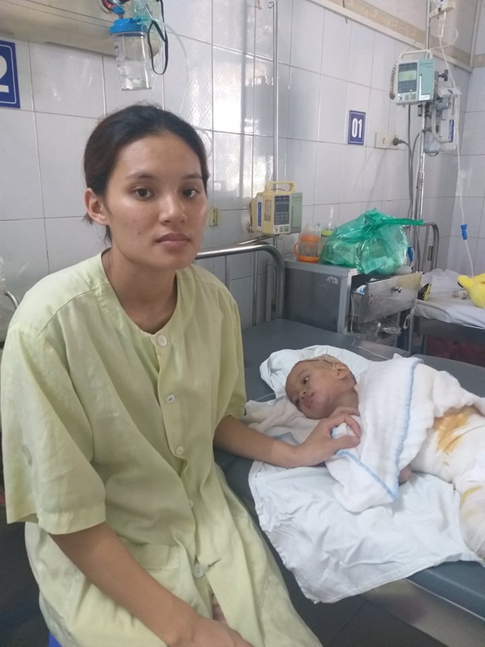 Ánh mắt cầu cứu của bé trai 3 tuổi bị bỏng nặng bên người mẹ đang mang thai: “Đau quá mẹ ơi...” - Ảnh 4. Ánh mắt cầu cứu của bé trai 3 tuổi bị bỏng nặng bên người mẹ đang mang thai: “Đau quá mẹ ơi...” - Ảnh 4.