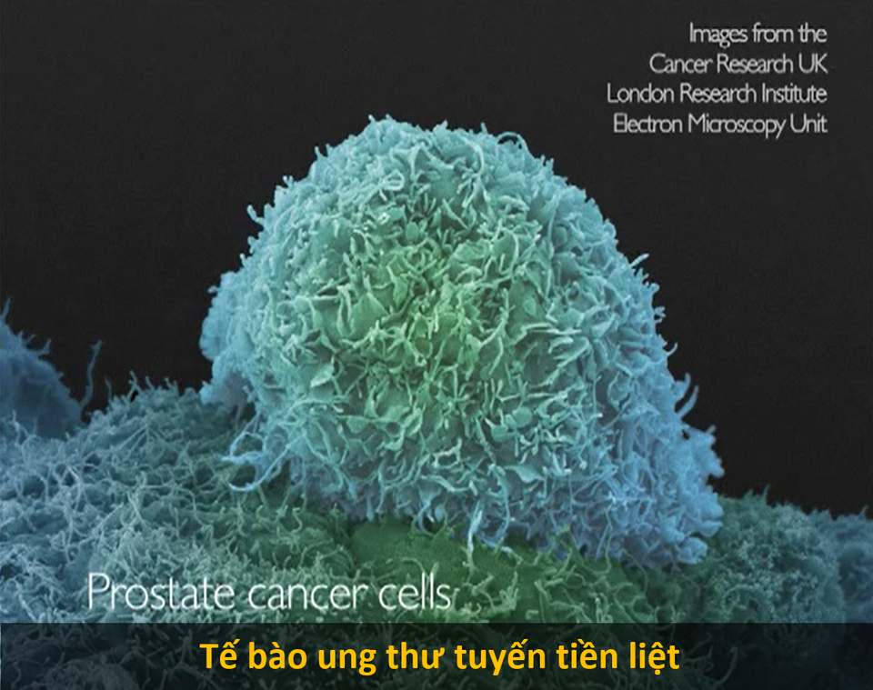 Cận cảnh hình hài những tế bào “chết chóc nhất mà con người từng biết đến - 9 Cận cảnh hình hài những tế bào “chết chóc nhất mà con người từng biết đến - 9