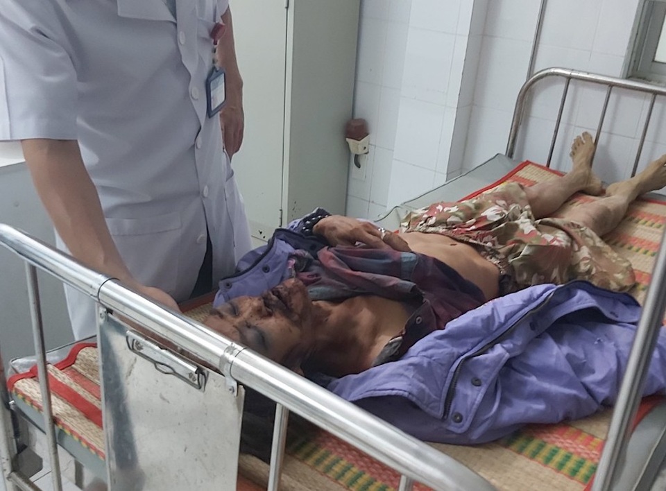 Phát hiện người đàn ông nghi bị voi quật chấn thương sọ não - 2 Phát hiện người đàn ông nghi bị voi quật chấn thương sọ não - 2