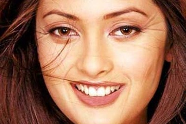 Nhìn nếp nhăn, đoán nguy cơ loãng xương