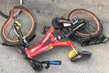 Đau đầu sau khi ngã xe đạp, bé 7 tuổi bất ngờ phát hiện chấn thương sọ não