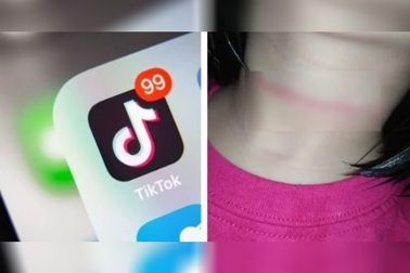 Bé gái 4 tuổi suýt mất mạng vì học theo video treo cổ trên TikTok