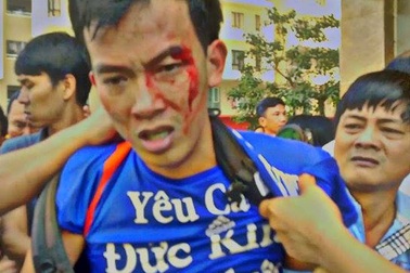 Vụ dân chung cư bị côn đồ đánh thương tích: Chủ đầu tư nói vô can?