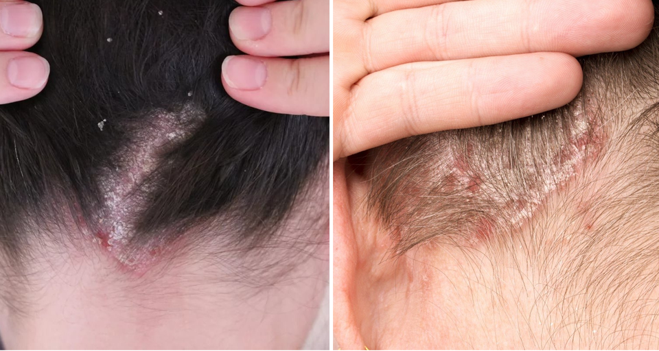 Combo làm tóc với giá rẻ và những hệ lụy của nó - 1 Combo làm tóc với giá rẻ và những hệ lụy của nó - 1