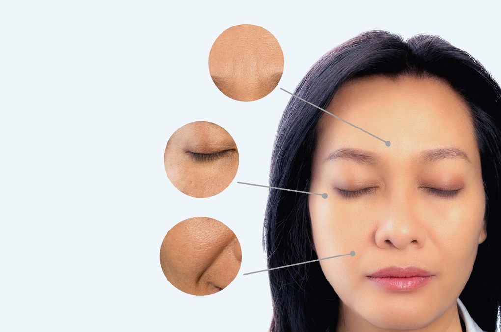 Chuyên gia da liễu chia sẻ bí quyết giúp chị em luôn sở hữu làn da sáng mịn, săn chắc sau tuổi 30 - 1 Chuyên gia da liễu chia sẻ bí quyết giúp chị em luôn sở hữu làn da sáng mịn, săn chắc sau tuổi 30 - 1
