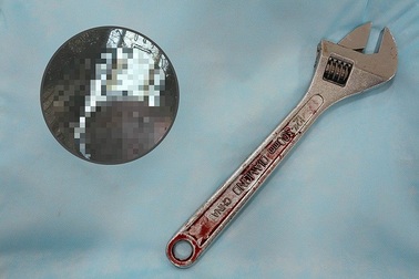 Sốc: Nhập viện cấp cứu vì thủ dâm bằng... mỏ lết