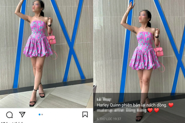 Khoe lông nách rậm rạp khi dự sự kiện: Cá tính hay sống ích kỷ?