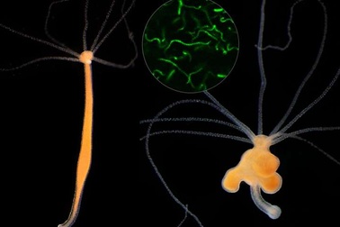 Liệu hệ vi sinh khỏe mạnh có tiềm ẩn nguyên nhân gây ung thư?