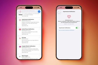 Người dùng Apple Watch đã có thể sử dụng tính năng cảnh báo huyết áp