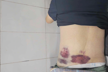 Một người bị đánh thương tích khi đỗ xe máy trên đất dự án