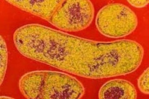 Các biểu hiện khi ngộ độc khuẩn gây liệt cơ