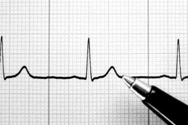 Bộ não con người lọc ra các hiệu ứng cảm giác của nhịp tim