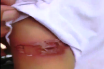 Vụ bé gái 7 tuổi nghi bị dí sắt nung đỏ vào người: Cha và mẹ kế nói gì?