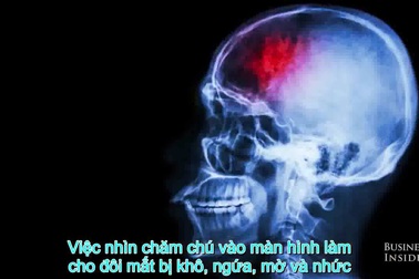 Cách đơn giản nhất để tránh mỏi mắt khi nhìn vào màn hình quá lâu