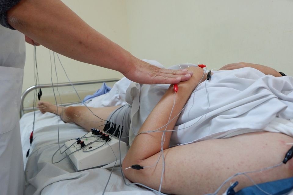 Nhiều người trẻ liệt người, méo miệng sau một đêm: Thủ phạm không xa lạ! - 2 Nhiều người trẻ liệt người, méo miệng sau một đêm: Thủ phạm không xa lạ! - 2