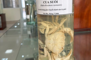 Người đàn ông bị sán tấn công phổi sau khi ăn món gỏi cua đặc sản