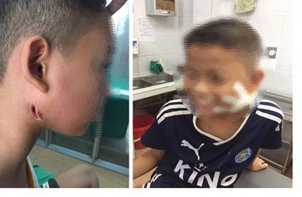 Hà Nội: Trong nửa tháng, 2 anh em ruột tử vong do nhiễm khuẩn Whitmore - 1 Hà Nội: Trong nửa tháng, 2 anh em ruột tử vong do nhiễm khuẩn Whitmore - 1