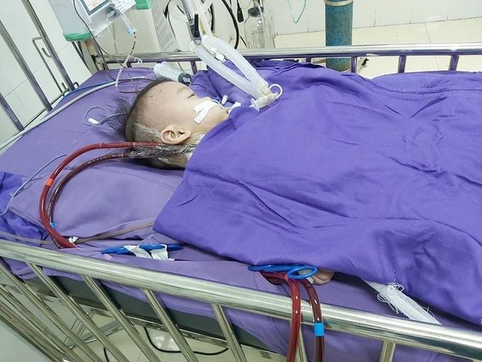 Sử dụng kỹ thuật tuần hoàn ngoài cơ thể để thắp sáng lên tia hi vọng cuối cùng, cứu sống bệnh nhân nhi viêm phổi nặng - Ảnh 1. Sử dụng kỹ thuật tuần hoàn ngoài cơ thể để thắp sáng lên tia hi vọng cuối cùng, cứu sống bệnh nhân nhi viêm phổi nặng - Ảnh 1.