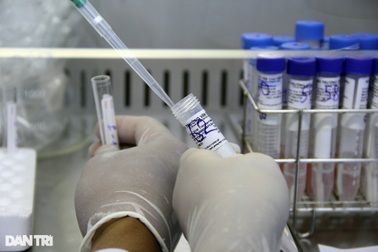 "Chúng tôi mua kit Việt Á mức thấp trong dải giá Bộ Y tế đưa ra"