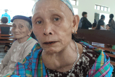 Cụ bà mang khối bướu cổ khổng lồ gần 20 năm