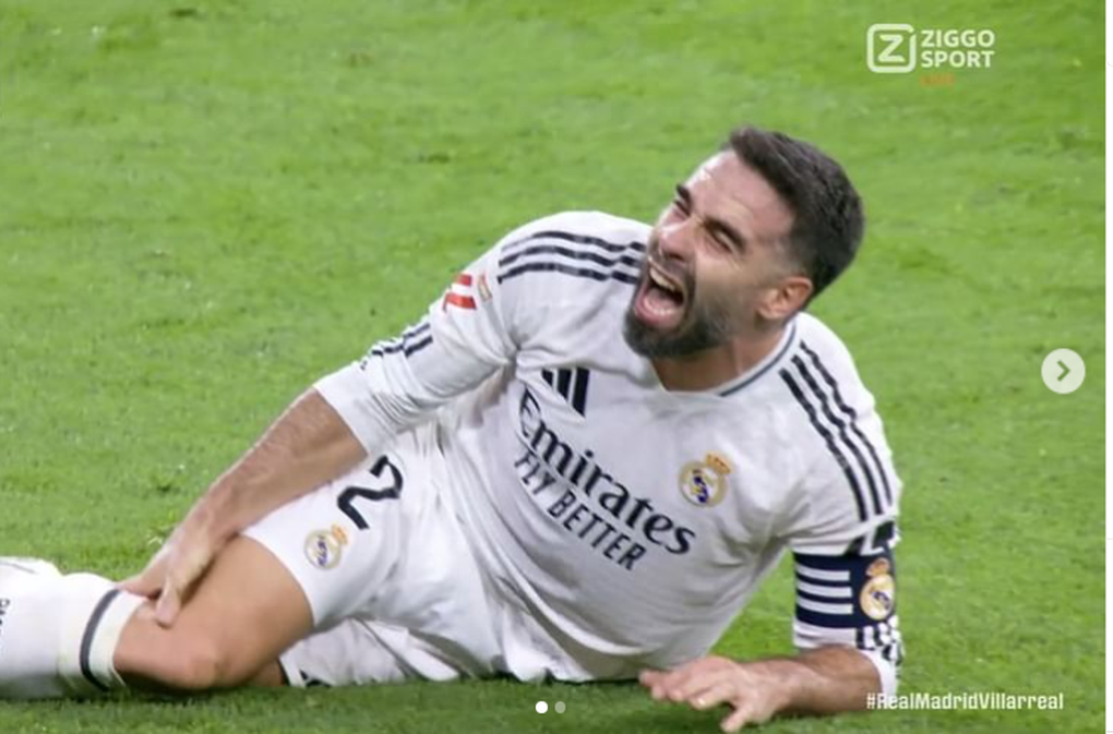 Real Madrid star suffers serious injury, deformed leg - 2