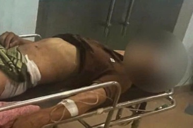 Cầm kéo xông vào quán cà phê đâm người trọng thương