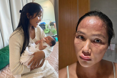 H'Hen Niê hé lộ gương mặt sưng tấy sau khi sinh, sức khỏe hiện ra sao?