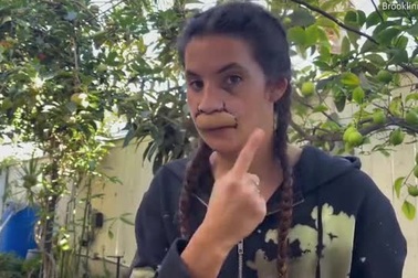 Brooklinn Khoury trong quá trình phẫu thuật chỉnh hình