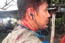 Long An: Chủ quán đánh toác đầu khách đã dọn đồ về quê