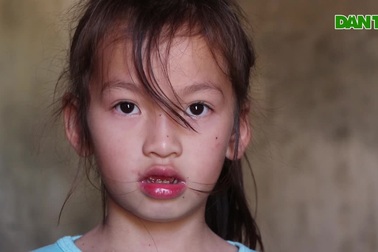 Người phụ nữ bị xe bò cán gãy xương, dập gan lo 2 con không có Tết