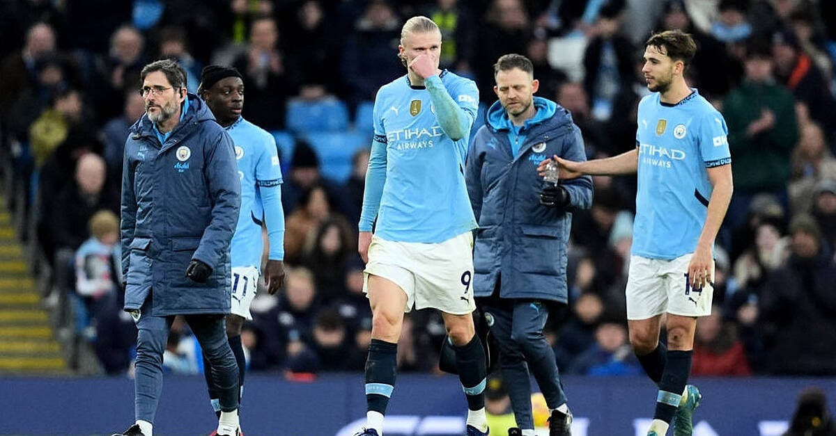 Manchester City sofre susto antes de grande jogo com o Real Madrid - 2 Man City chịu cú sốc trước trận đại chiến với Real Madrid - 2