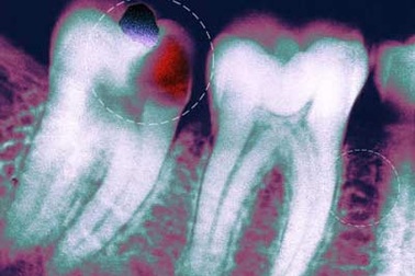 Top những vấn đề ở miệng