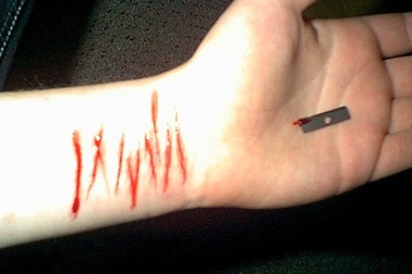 Hãi hùng nhiều người trẻ thích cứa tay rớm máu để tự hành xác