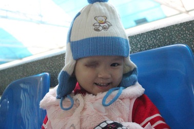 Hơn 76 triệu đồng đến với cô bé một mắt