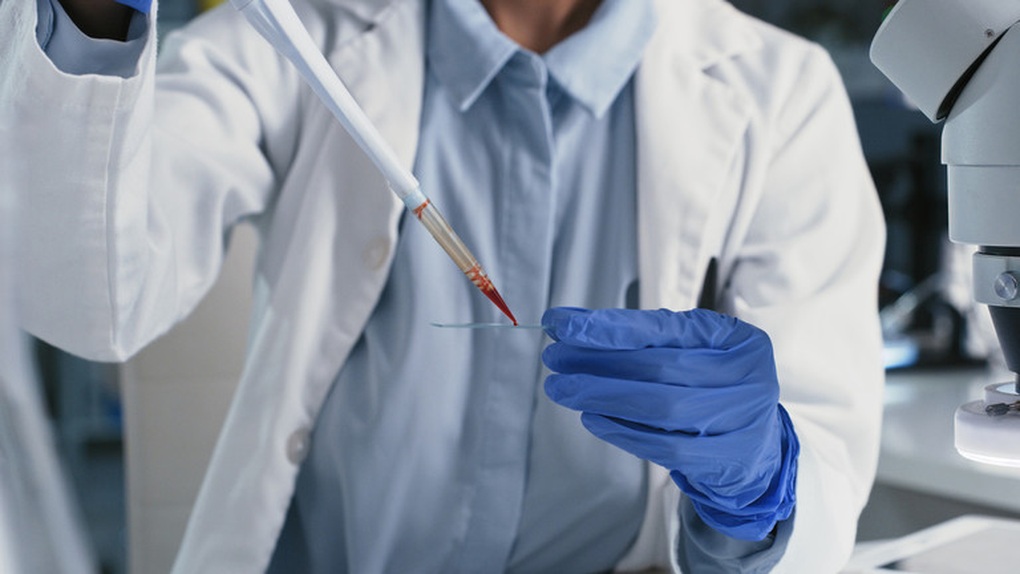 Viện nghiên cứu Nga công bố lộ trình phát triển vaccine HIV - 1 Viện nghiên cứu Nga công bố lộ trình phát triển vaccine HIV - 1