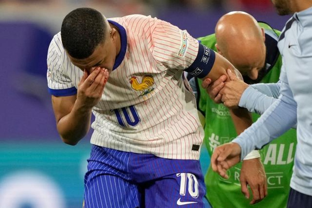 Mbappe phải đeo mặt nạ thi đấu cho đội tuyển Pháp ở Euro 2024 - 2 Mbappe phải đeo mặt nạ thi đấu cho đội tuyển Pháp ở Euro 2024 - 2