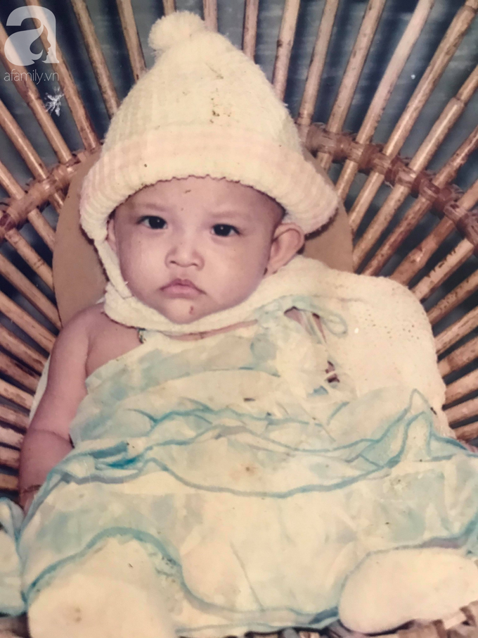 Bé gái biến dạng khuôn mặt, mất một bên tai và ước mơ nhói lòng: Em muốn làm họa sĩ để vẽ mình đẹp hơn - Ảnh 1. Bé gái biến dạng khuôn mặt, mất một bên tai và ước mơ nhói lòng: Em muốn làm họa sĩ để vẽ mình đẹp hơn - Ảnh 1.