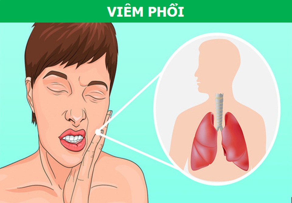 Những cơn đau kỳ lạ xuất phát từ răng miệng nói lên điều gì về sức khỏe? - 4 Những cơn đau kỳ lạ xuất phát từ răng miệng nói lên điều gì về sức khỏe? - 4