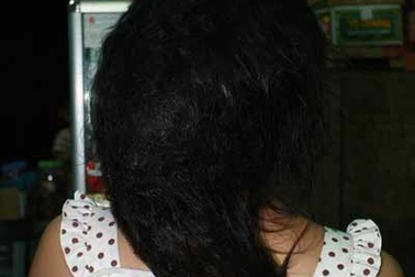 Kỳ lạ mái tóc bị bết thành nhiều hình khối